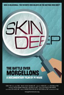 دانلود مستند Skin Deep: The Battle Over Morgellons 2019104233-867366786